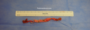 Figure 5: Mesh Extracted