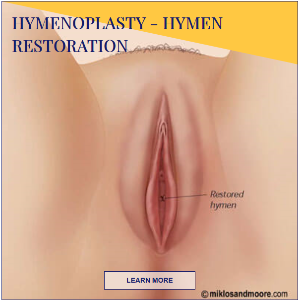 hymenoplasty - hymen restoration