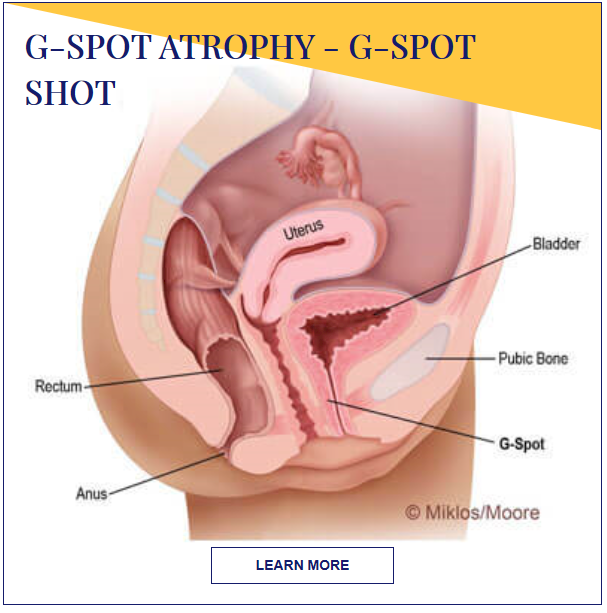 G-spot atrophy - g-spot shot