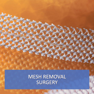 mesh complications
