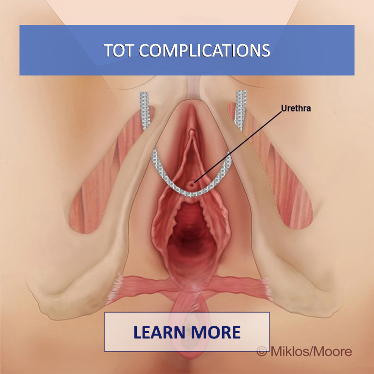 TOT-Complications