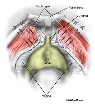 supported urethra