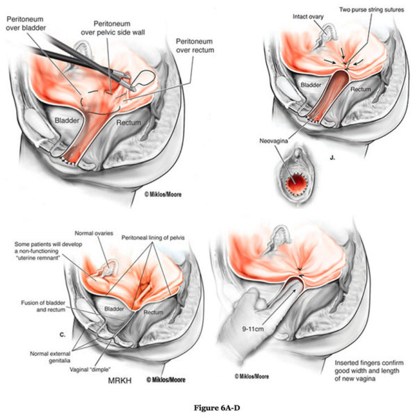 surgical-procedure-fig6A-D