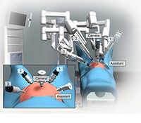 Robotic Sacrocolpopexy 4-5 abdominal incision surgery 