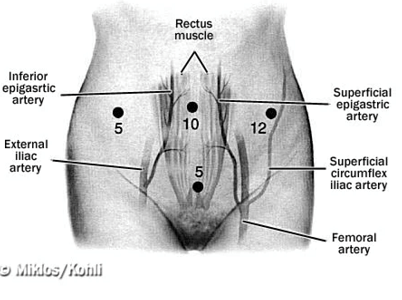 MRKH patient - no vagina