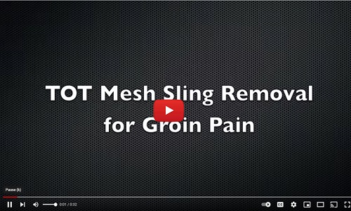 TOT-mesh-sling-removal-groin-pain