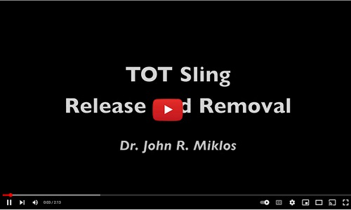 TOT-sling-release-removal