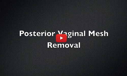 posterior-vaginal mesh removal