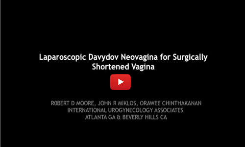 shortened-vagina