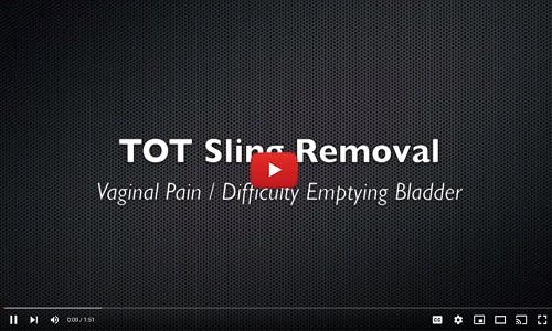 tot sling removal