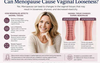 Woman experiencing menopausal changes and researching whether menopause can cause vaginal looseness, vaginal laxity, and pelvic floor weakness.